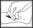 Emla crema-figura4